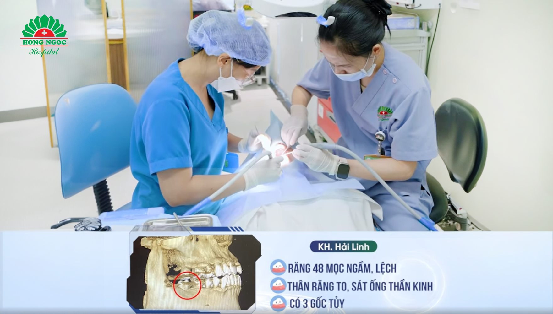 nhổ răng khôn mọc ngầm